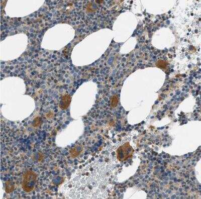 Immunohistochemistry-Paraffin: MAN2A2 Antibody [NBP1-83159]