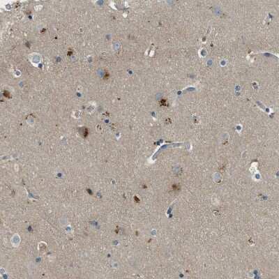 Immunohistochemistry-Paraffin: MAN2A2 Antibody [NBP1-83159]