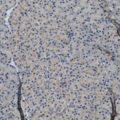 Immunohistochemistry-Paraffin: MAN2A2 Antibody [NBP1-83159]