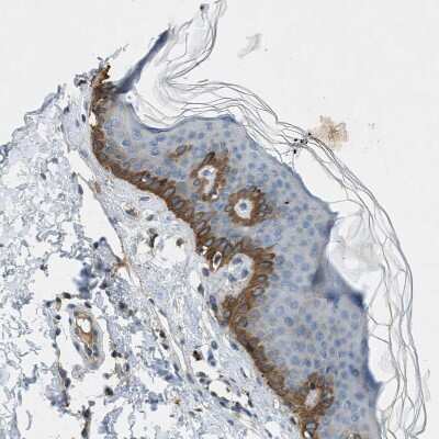 Immunohistochemistry-Paraffin: MAN2A2 Antibody [NBP1-83159]