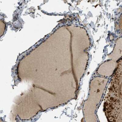 Immunohistochemistry-Paraffin: MAN2A2 Antibody [NBP1-83159]