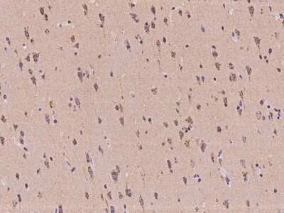 Immunohistochemistry-Paraffin: MAN2A2 Antibody [NBP2-98095]