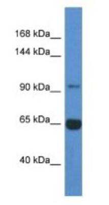 Western Blot: MAN2A2 Antibody [NBP1-74213]