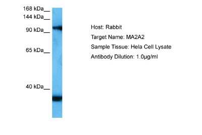 Western Blot: MAN2A2 Antibody [NBP2-87774]