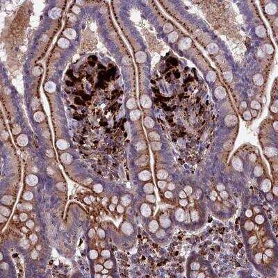 Immunohistochemistry-Paraffin: MAN2B1 Antibody [NBP1-81326]