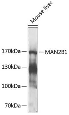 Western Blot: MAN2B1 AntibodyBSA Free [NBP3-05138]