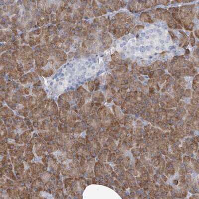 Immunohistochemistry-Paraffin: MAN2B2 Antibody [NBP1-81460]