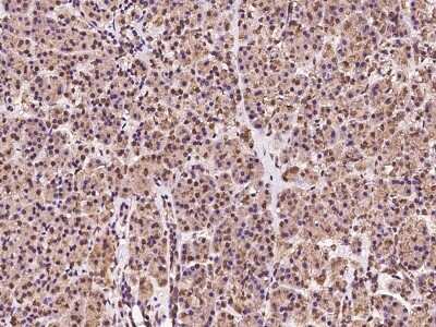 Immunohistochemistry-Paraffin: MAN2B2 Antibody [NBP2-97471]