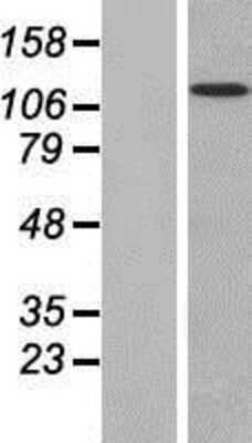 Western Blot: MAN2B2 Overexpression Lysate [NBP2-07195]