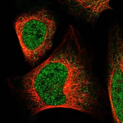 Immunocytochemistry/ Immunofluorescence: MAN2C1 Antibody [NBP1-87729]