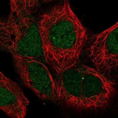 Immunocytochemistry/ Immunofluorescence: MAN2C1 Antibody [NBP2-57246]