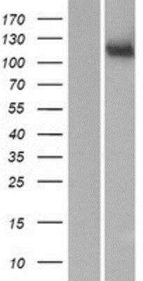 Western Blot: MAN2C1 Overexpression Lysate [NBP2-10400]