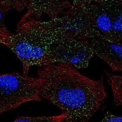 Immunocytochemistry/ Immunofluorescence: MANBA Antibody [NBP2-47384]