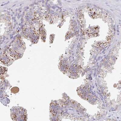 Immunohistochemistry-Paraffin: MANBA Antibody [NBP2-47384]