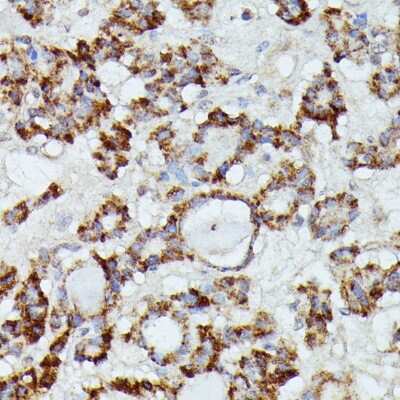 Immunohistochemistry-Paraffin: MANBA Antibody - Azide and BSA Free [NBP3-04803]