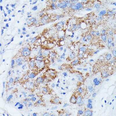 Immunohistochemistry-Paraffin: MANBA Antibody - Azide and BSA Free [NBP3-04803]
