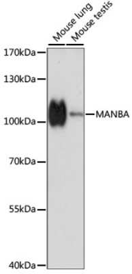 Western Blot: MANBA AntibodyAzide and BSA Free [NBP3-04803]