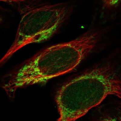 Immunocytochemistry/ Immunofluorescence: MANBAL Antibody [NBP2-56848]