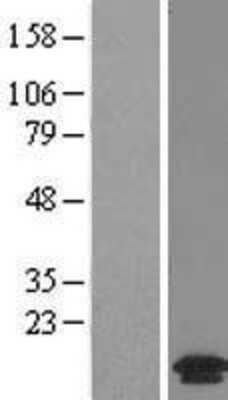 Western Blot: MANBAL Overexpression Lysate [NBL1-12839]