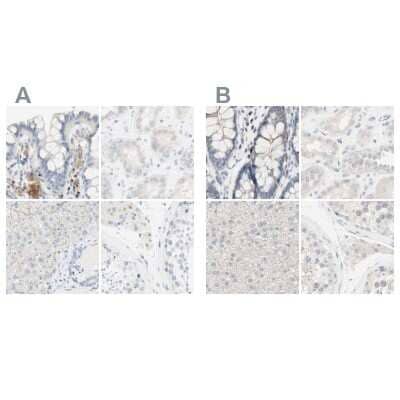 Immunohistochemistry-Paraffin: MANEA Antibody [NBP1-82279]