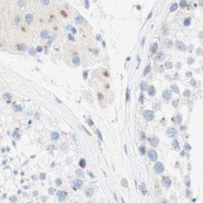 Immunohistochemistry-Paraffin: MANEA Antibody [NBP1-82279]