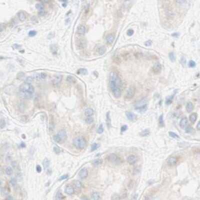 Immunohistochemistry-Paraffin: MANEA Antibody [NBP1-82279]