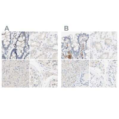 Immunohistochemistry-Paraffin: MANEA Antibody [NBP1-83710]
