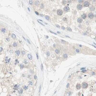Immunohistochemistry-Paraffin: MANEA Antibody [NBP1-83710]