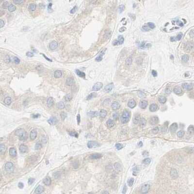 Immunohistochemistry-Paraffin: MANEA Antibody [NBP1-83710]