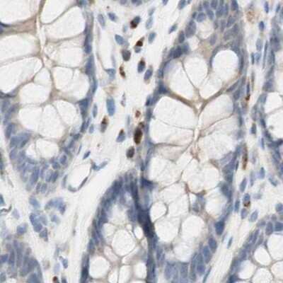 Immunohistochemistry-Paraffin: MANEA Antibody [NBP1-83710]