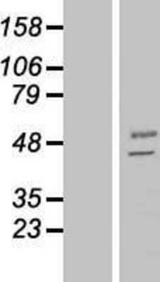 Western Blot: MANEA Overexpression Lysate [NBP2-06290]