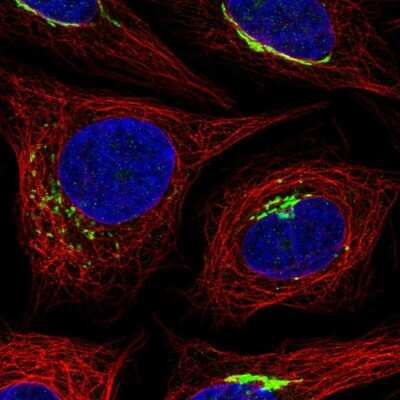 Immunocytochemistry/ Immunofluorescence: MANEAL Antibody [NBP2-56021]