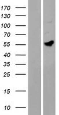 Western Blot: MANEAL Overexpression Lysate [NBP2-09385]