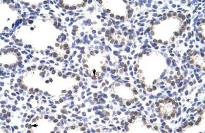 Immunohistochemistry: MANSC1 Antibody [NBP2-85252]