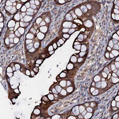 Immunohistochemistry: MANSC4 Antibody [NBP1-91136]