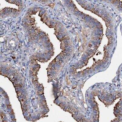 Immunohistochemistry-Paraffin: MANSC4 Antibody [NBP2-32618]