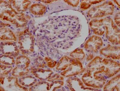 Immunohistochemistry: MAO-A Antibody (4C11) [NBP3-15161]