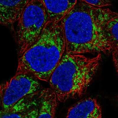 Immunocytochemistry/ Immunofluorescence: MAO-A Antibody [NBP2-38738]