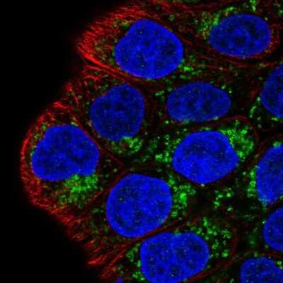 Immunocytochemistry/ Immunofluorescence: MAO-A Antibody [NBP2-38868]