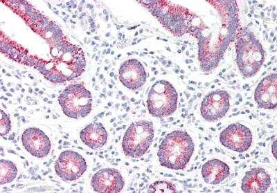 Immunohistochemistry-Paraffin: MAO-A Antibody [NB100-2417]