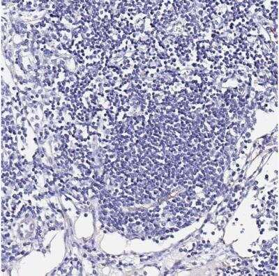 Immunohistochemistry-Paraffin: MAO-A Antibody [NBP2-38868]