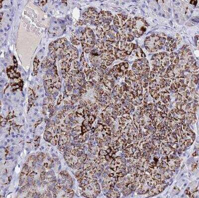 Immunohistochemistry-Paraffin: MAO-A Antibody [NBP2-38868]