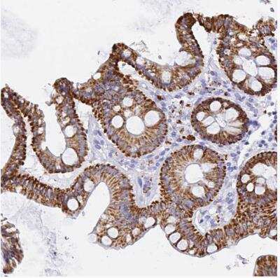 Immunohistochemistry-Paraffin: MAO-A Antibody [NBP2-38868]