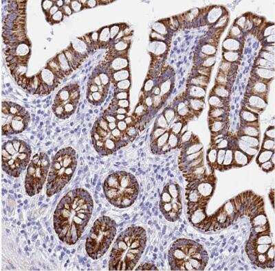 Immunohistochemistry-Paraffin: MAO-A Antibody [NBP2-38868]