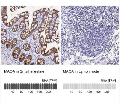 Immunohistochemistry-Paraffin: MAO-A Antibody [NBP2-38868]