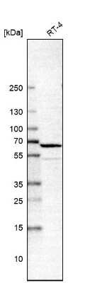 Western Blot: MAO-A Antibody [NBP2-38868]