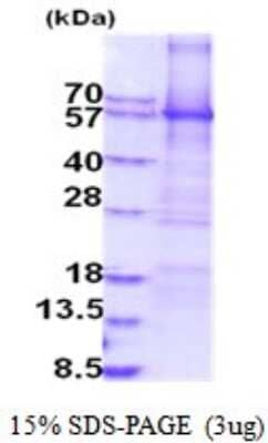 SDS-PAGE: Recombinant Human MAO-A His Protein [NBP2-52024]