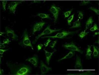 Immunocytochemistry/ Immunofluorescence: MAP1 Antibody (4A1) [H00064112-M02]