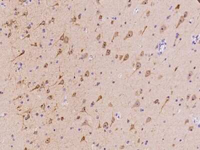 Immunohistochemistry-Paraffin: MAP1 Antibody [NBP2-97771]