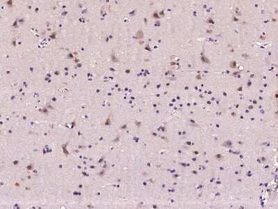 Immunohistochemistry-Paraffin: MAP1 Antibody [NBP2-98817]